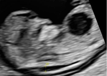 Casi del Mese di Marzo 2026