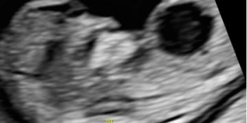 Casi del Mese di Marzo 2026