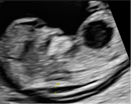 Casi del Mese di Marzo 2026