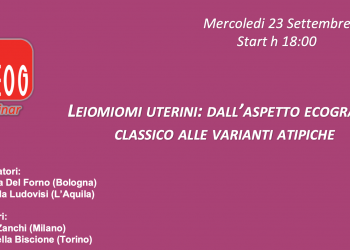 Webinar SIEOG giovani di Settembre 2026