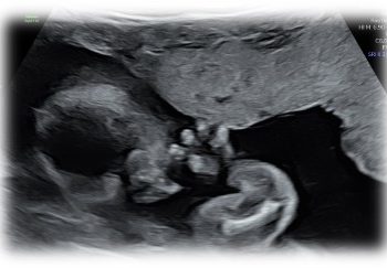 Casi del Mese di Ottobre 2026