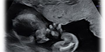 Casi del Mese di Ottobre 2026